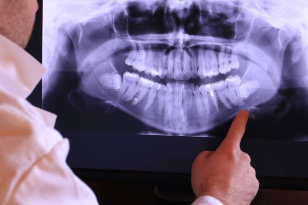 Best Emergency Tooth Extraction in Presidio, TX