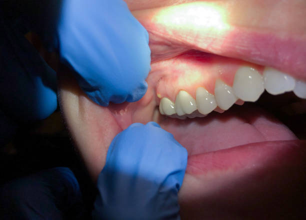 Best Emergency Dental Care for Broken or Chipped Teeth in Presidio, TX